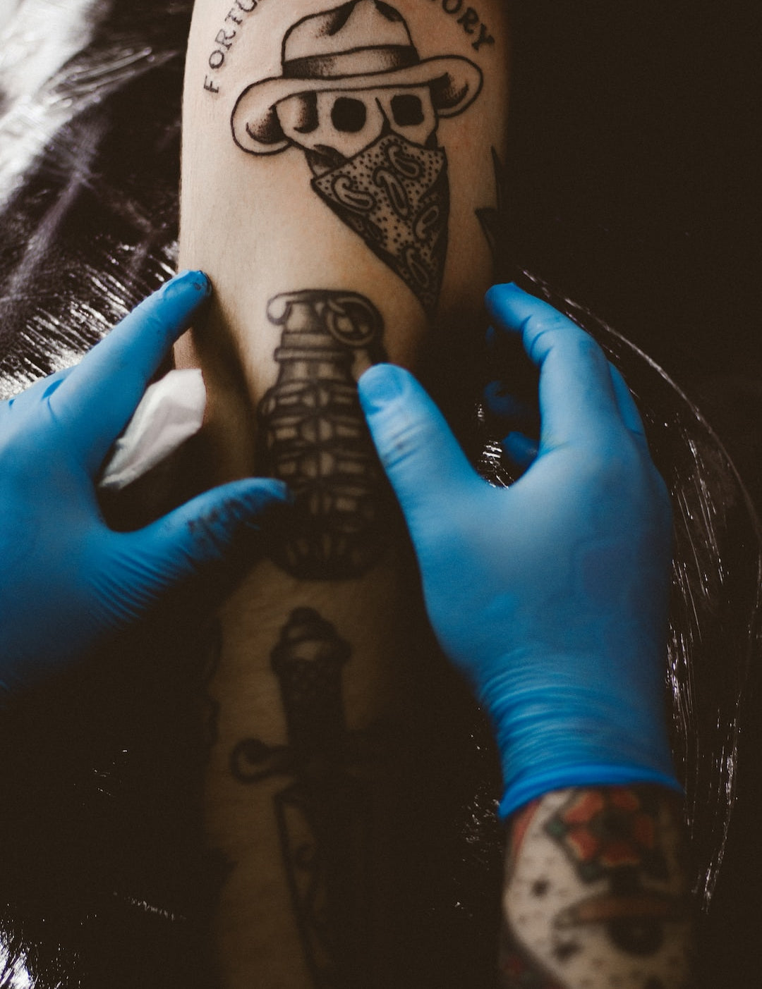 The Rise of Laser Tattoo Removal: How It Works