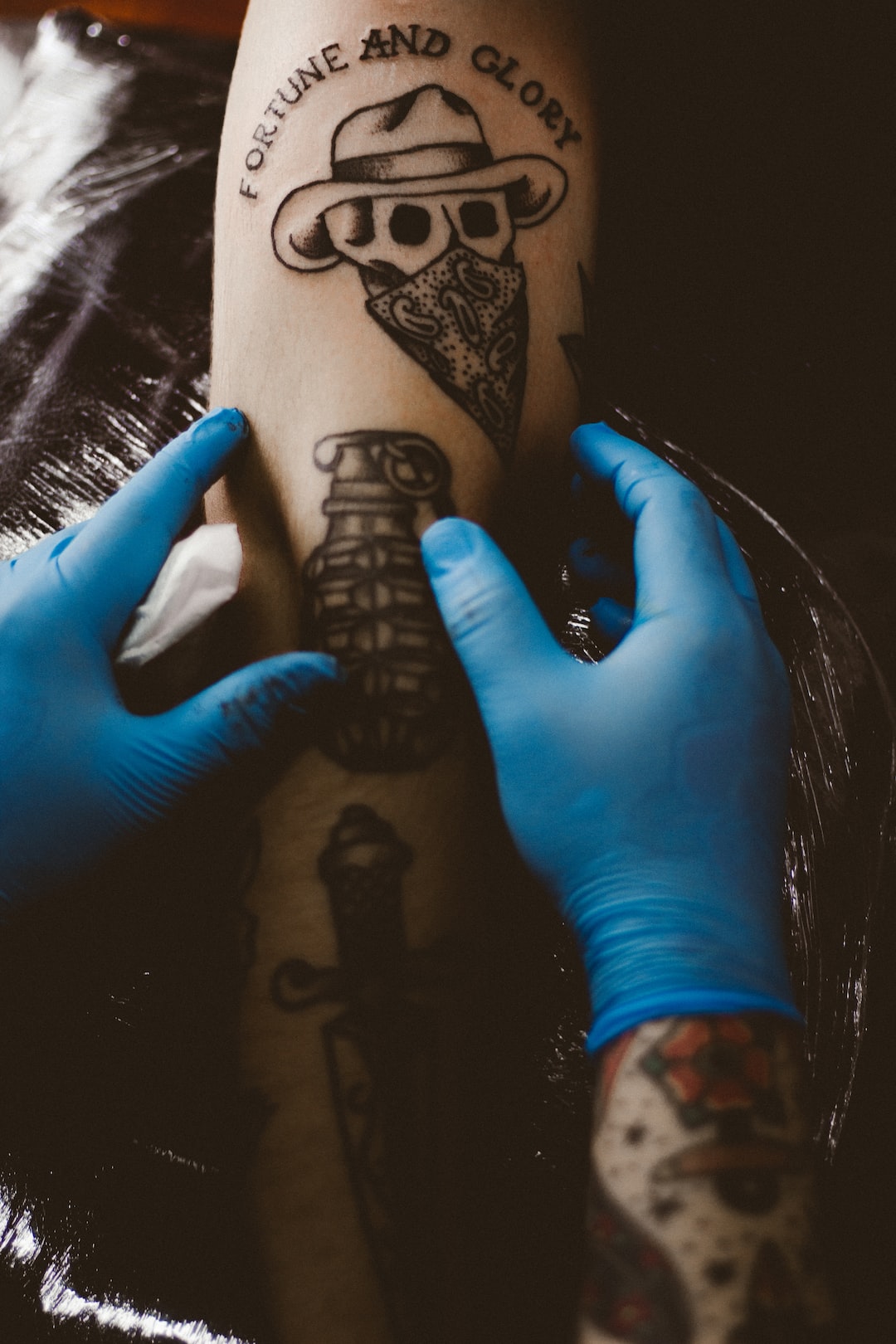 The Rise of Laser Tattoo Removal: How It Works