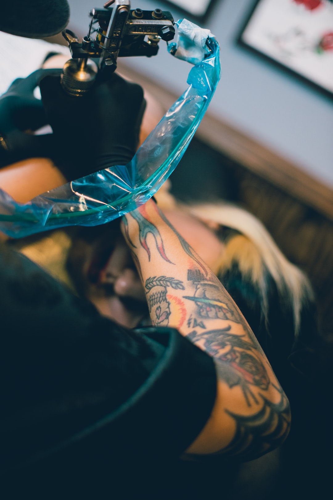 Considering Laser Tattoo Removal? Here's What You Need to Know