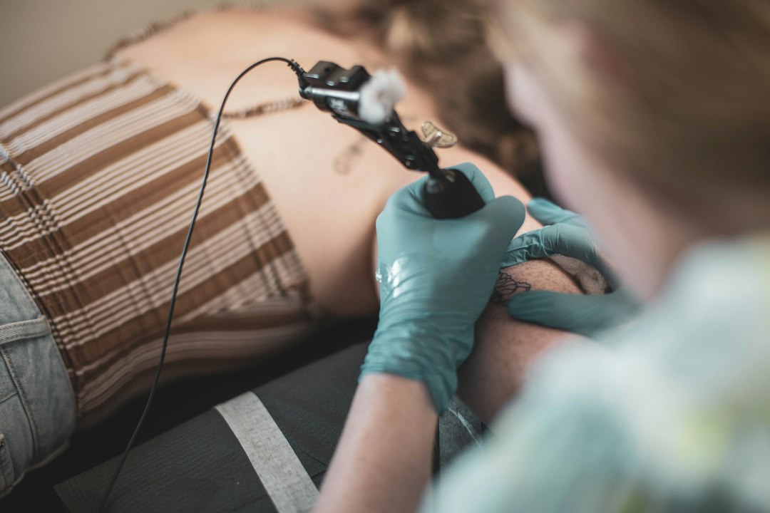 Tattoo Removal Techniques: Comparing Laser, Surgical, and Home Remedies